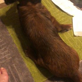 脊髄軟化症①の画像