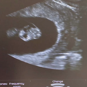 母子手帳もらいましたの画像