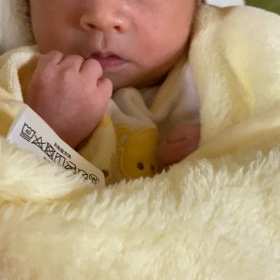 生後3週間の画像