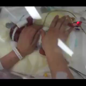 11/17 世界早産児デーの画像