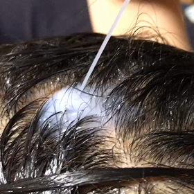 頭皮水入れの画像