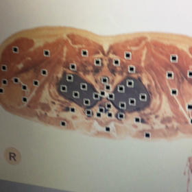 交通事故後にすぐ波動改善をオススメします。の画像