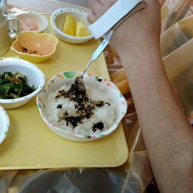 ギラン・バレー症候群の画像