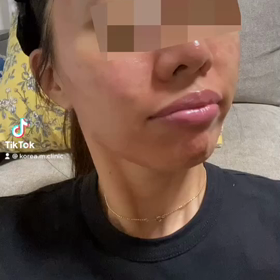 みにょん式poreless(毛穴がなくなる)美肌ツヤ肌バージョンの画像