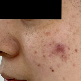 変われない肌はないの画像