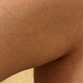 病気になった経緯(ちょっと真面目)の画像