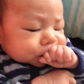 舌小帯短縮症の画像