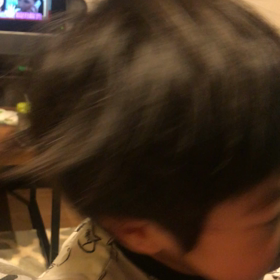 怪獣化した息子は、突発性湿疹だった❗️の画像