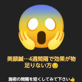 美顔鍼の効果が物足りない方はの画像