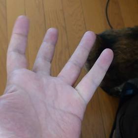 退院して4日が経った。の画像