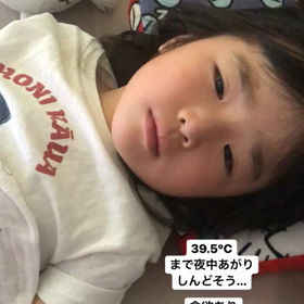 ヘルパンギーナの画像