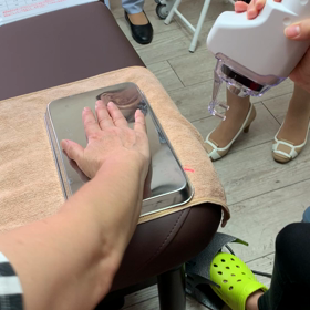 CO2フラクショナル、年齢が出てしまう手‼️の画像