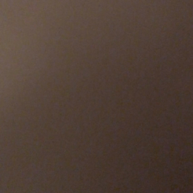 脊髄軟化症⑥の画像