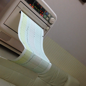 しゃっくり 笑の画像