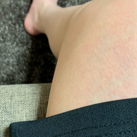 疲れると こうなる〰️の画像