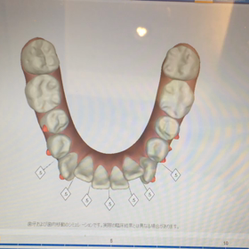 下の歯、ムービーの画像