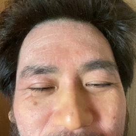 トランペット、パイナップルがどう？の画像