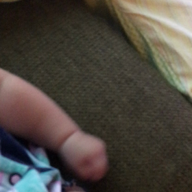 癌の疑いの画像