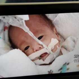 35w5d～生後88日目の画像