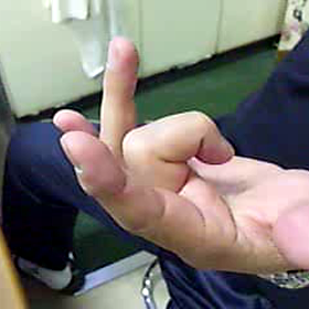 バネ指改善②の画像