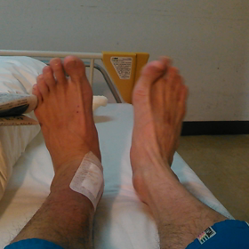 足首のプレートの画像