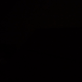 風邪による喘鳴の画像