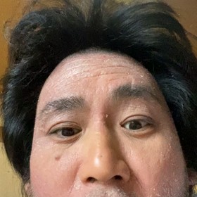 イッサ手壊し犯罪。の画像