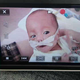 生後4ヵ月(修正4日目)の画像