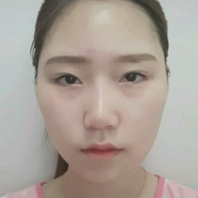 [韓国整形・韓国美容]DA美容外科♥BEFORE/AFTER症例♥の画像