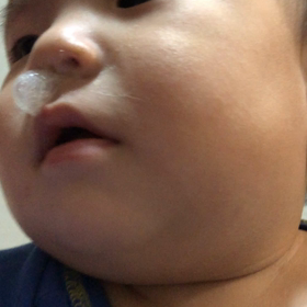 ⚡️閲覧注意⚡️昨日の末っ子三男の画像