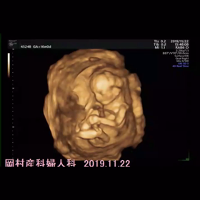 安定期を迎えました♡の画像