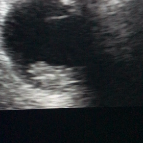 エコー動画　9w6dの画像