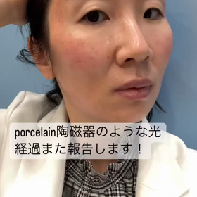 みにょん式poreless(ポアレス、毛穴がなくなる)新プランの画像