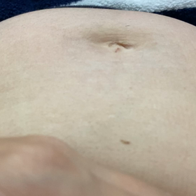 胎動動画の画像