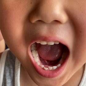 もう少しで抜けそう✨の画像