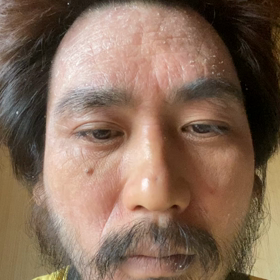 HYDE犯罪ばれの画像