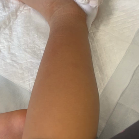 ※閲覧注意　形成外科への画像