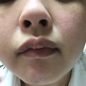 みなのヒゲのなやみ、の画像