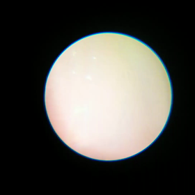 ブラインシュリンプって どんなエビ？？の画像