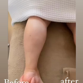 Before after！の画像