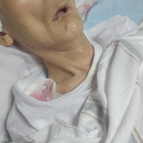 ☆ コロナワクチン二回目  接種3日目朝  ☆の画像