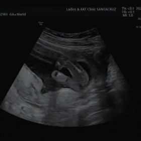 性別がわかりました！の画像