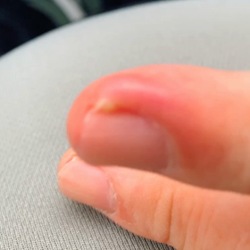 右が呪われてる‼️の画像