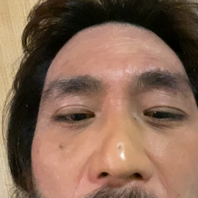 ②HYDE犯罪舌ばれの画像