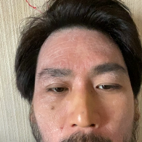 ラルク？の画像