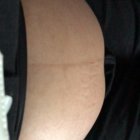 35w1d   こんな動きしますか？の画像