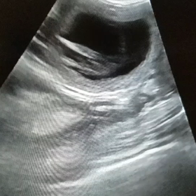 次の出産予定ありの画像