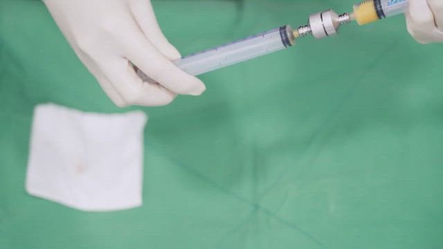 アイニーク美容外科｜ナノ脂肪移植は普通の脂肪移植と何が違うの？の記事動画