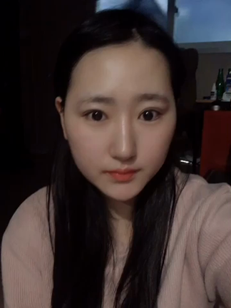 【韓国整形/韓国美容外科】【バッカルファット＋顎ライン脂肪吸引】症例動画の記事動画