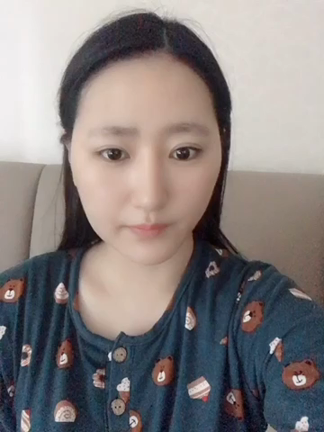 【韓国整形/韓国美容外科】【バッカルファット＋顎ライン脂肪吸引】症例動画の記事動画